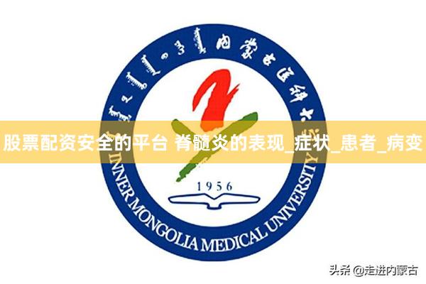 股票配资安全的平台 脊髓炎的表现_症状_患者_病变